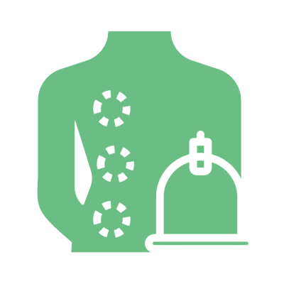 hijamah-cupping